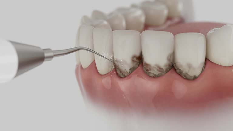 Reliable Dental Implants contractor in Leominster, MA by Smile Center Dentistry